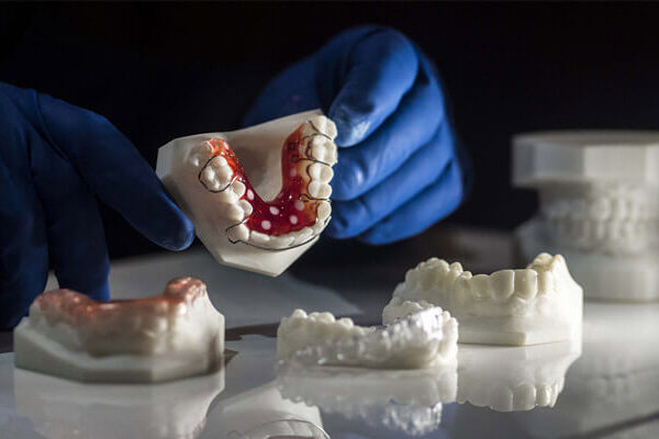 Printarea 3D in industria stomatologiei