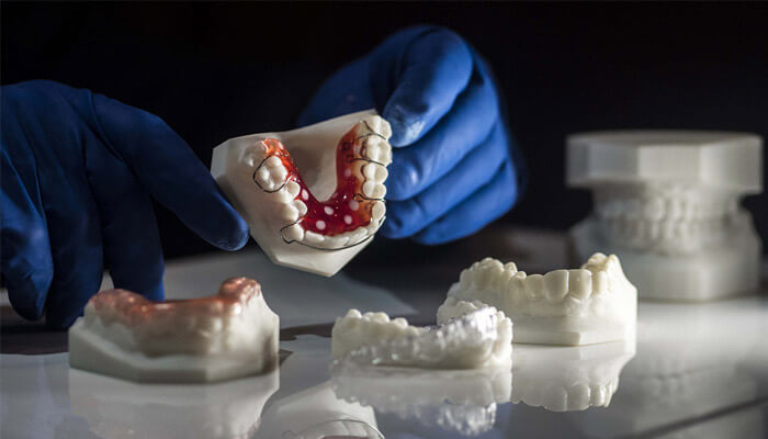 Printarea 3D in industria stomatologiei